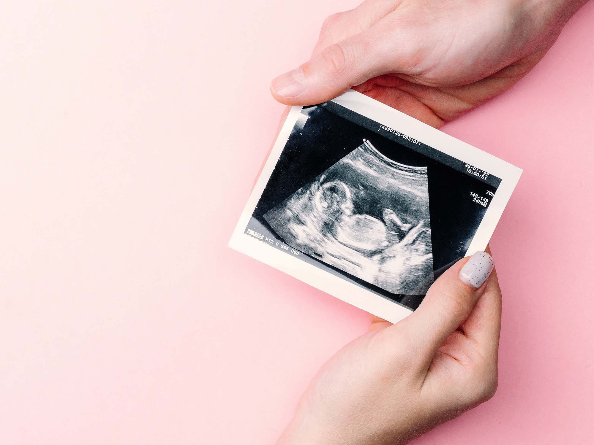 Madre dando comida a su bebé